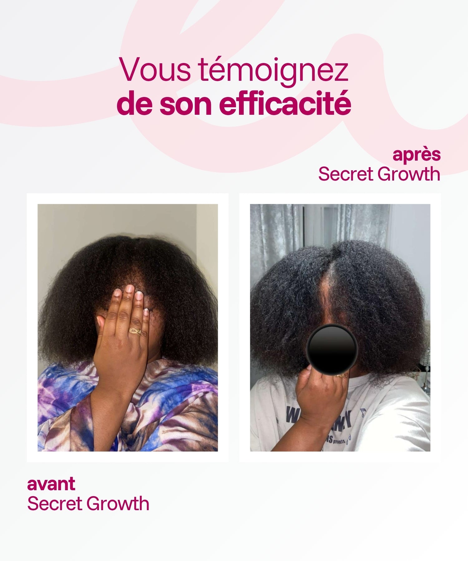 Secret Growth | Huile Pousse Cheveux