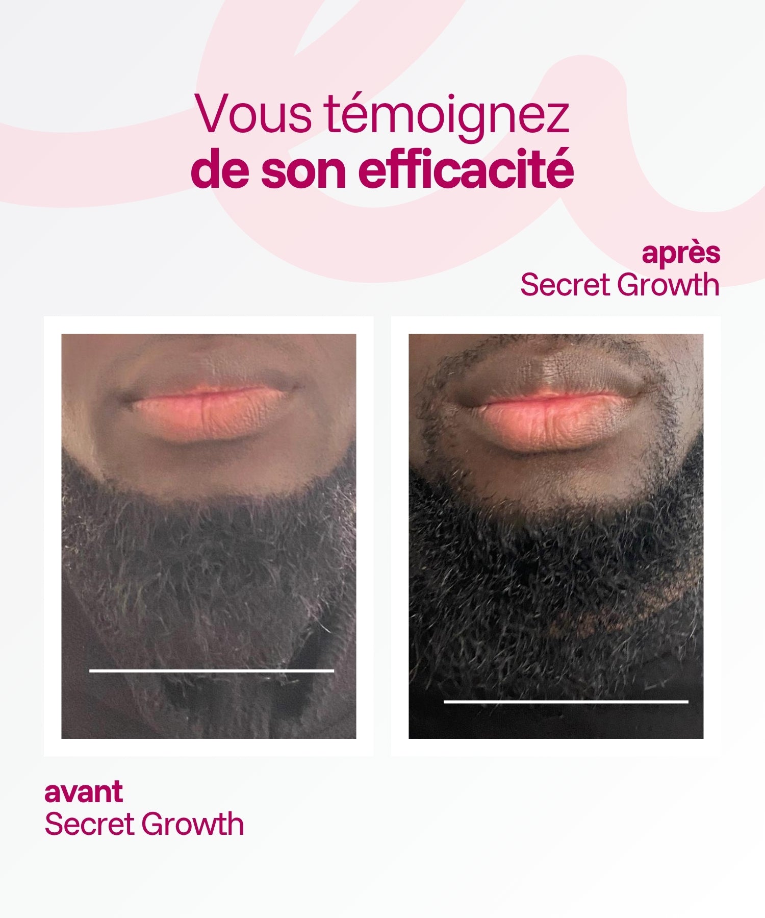 Secret Growth | Huile Pousse Cheveux