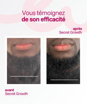 Secret Growth | Huile Pousse Cheveux