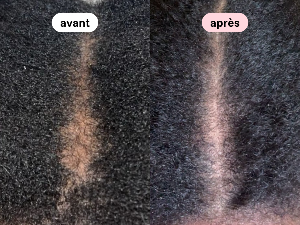 koyeliavtapr.png